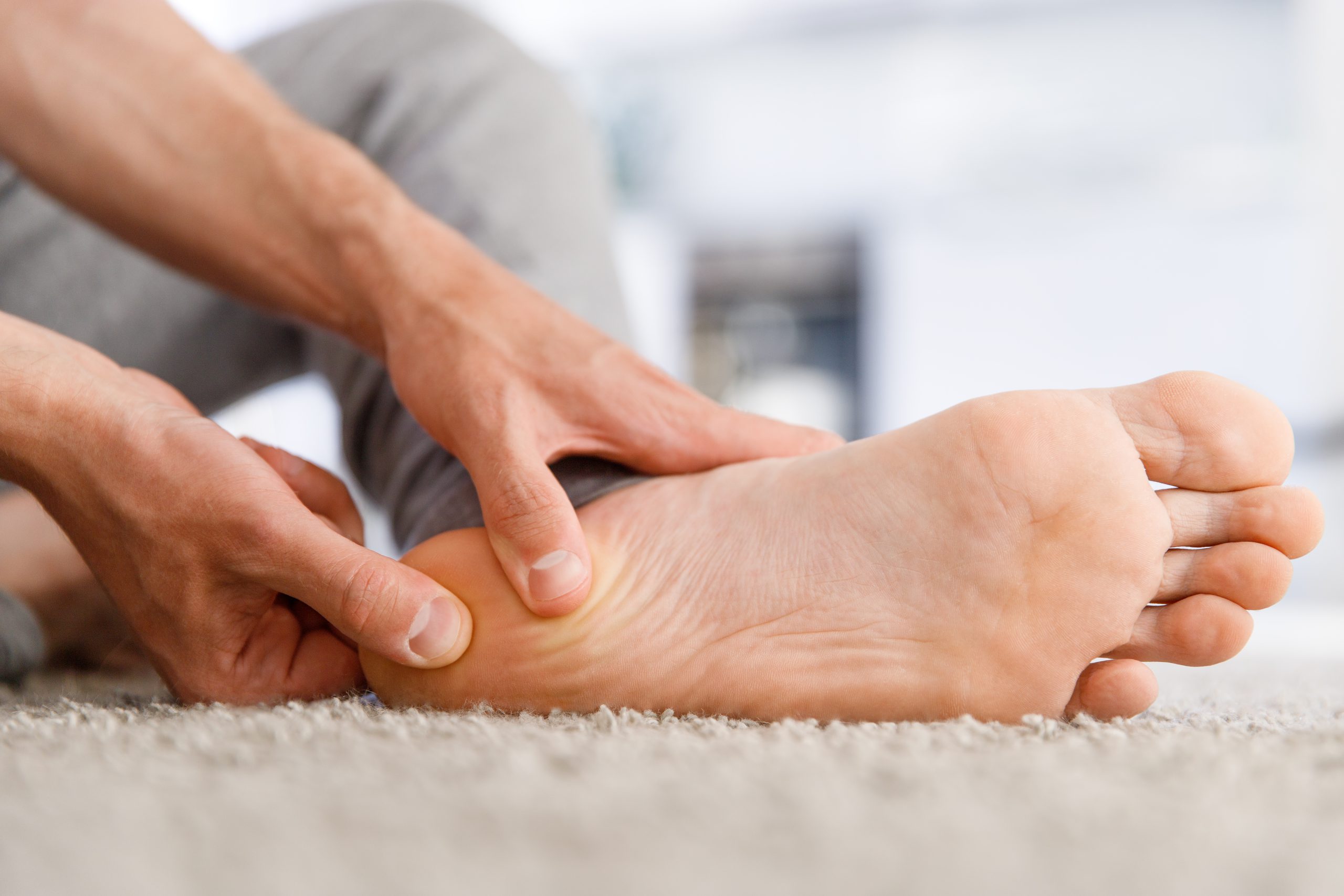 origen fascitis plantar
