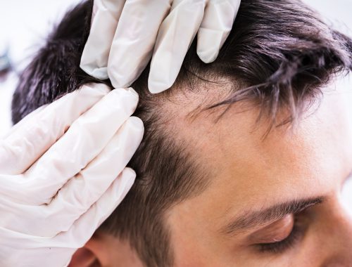 tricologo-dermatologia-patologia-enfermedad-cabello_rec