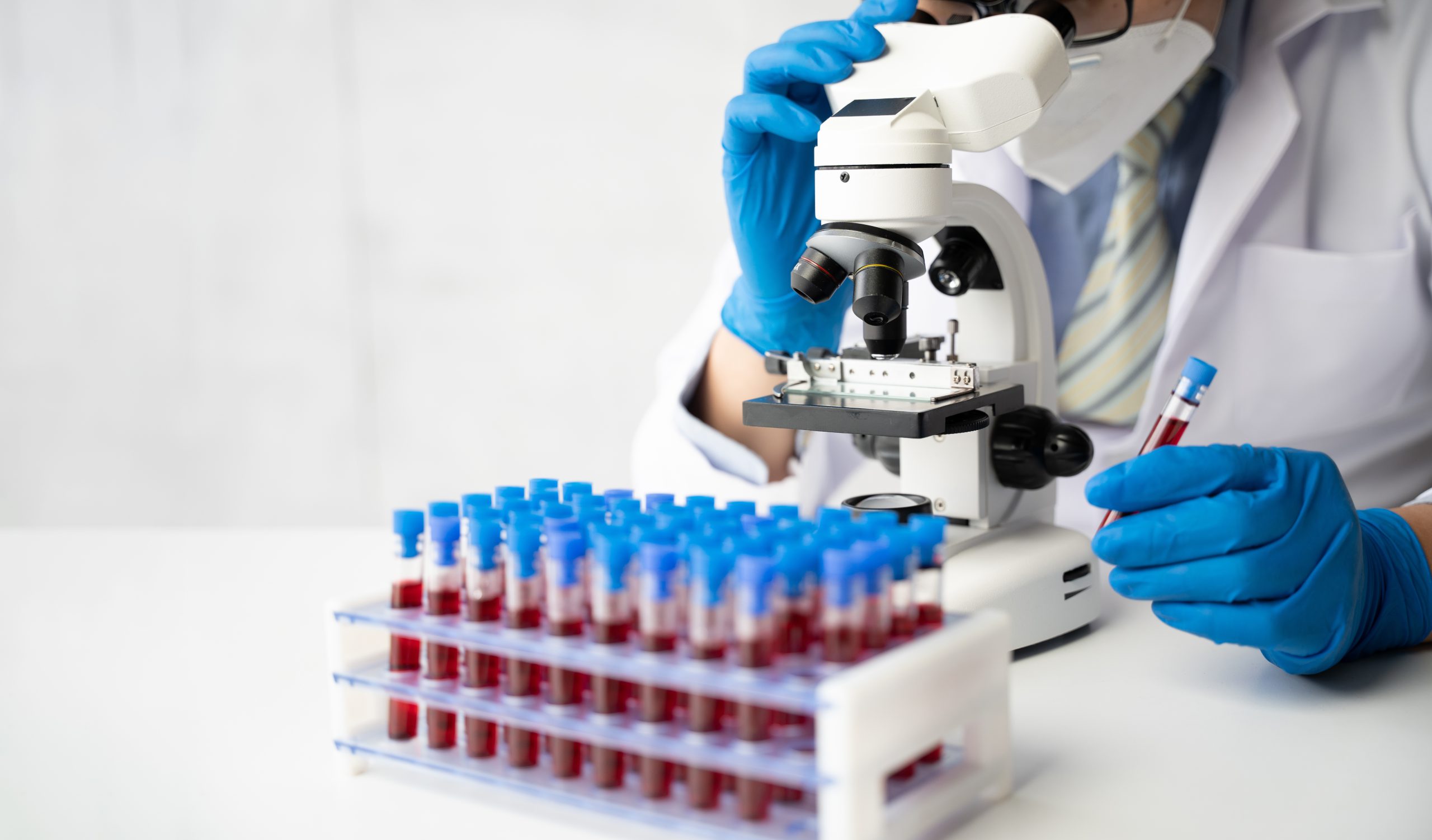 cancer-tumor-hematologico-sangre