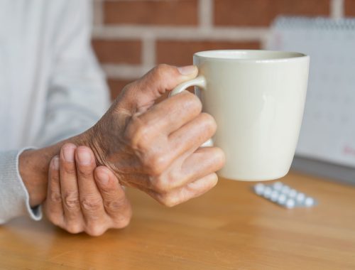 parkinson-neurodegeneracion-tratamiento